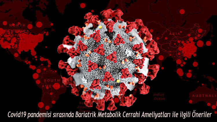 Covid19 pandemisi sırasında Bariatrik Metabolik Cerrahi Ameliyatları ile ilgili Öneriler